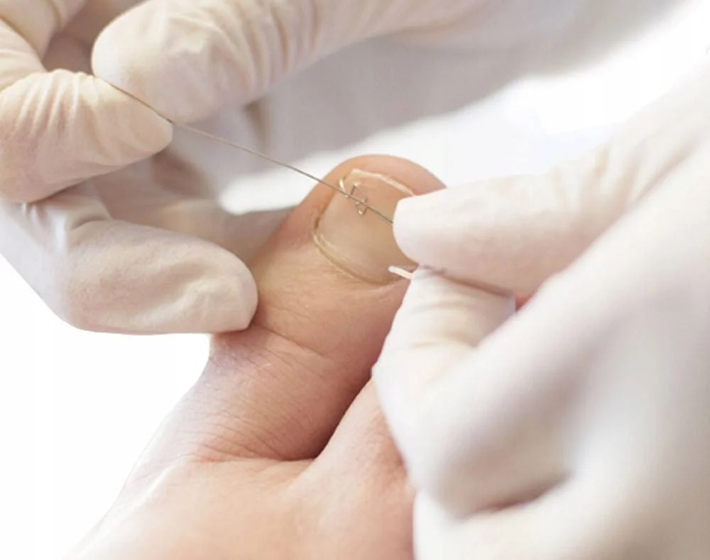 Dlaczego paznokcie u stóp powinny być zdrowe?